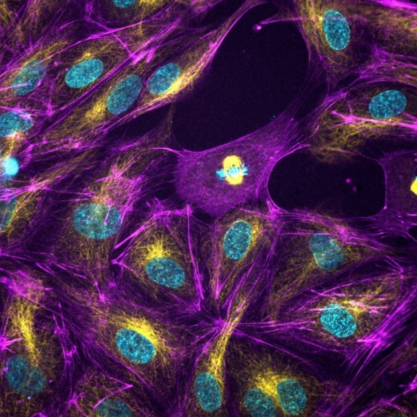 染色的HUVECs细胞.jpg